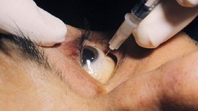 tratamiento, pinchazo ojo, ceguera, retina, retinopatia