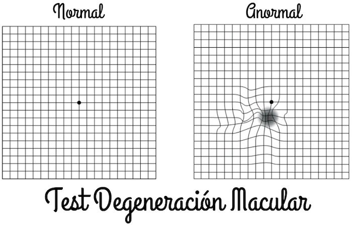 degeneracion macular test