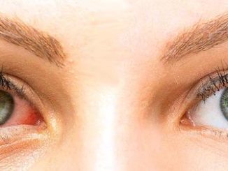 ojo seco rojo picor