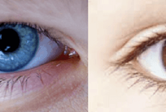 cambiar color ojos