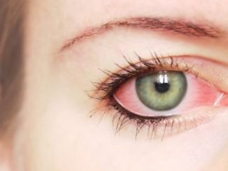 ojo rojo conjuntivitis