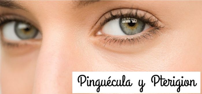 pinguecula-pterigion-ojo