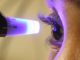 presion intraocular ojo